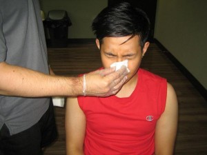 Care for individuals with Epistaxis